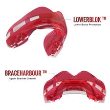 Chránič zubů Safe Jawz Ortho Series Ice Pink